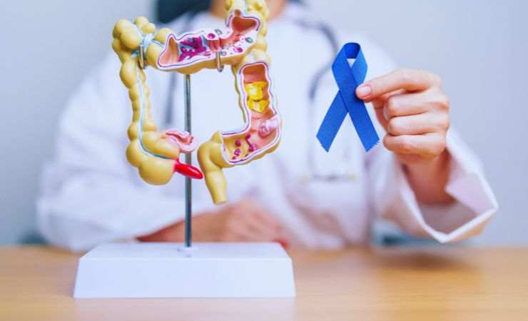 modellino del colon e una dottoressa
