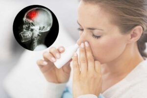 ragazza con spruzzino naso e una lastra del cranio